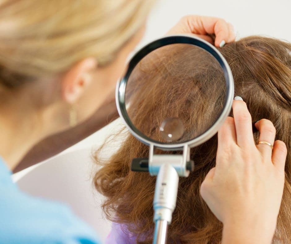 Vši &#8211; 6 tipov na liečbu a prevenciu