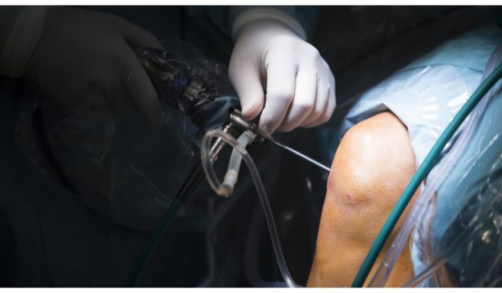 Ako dlho bolí koleno po artroskopií - 6 dôležitých informácií