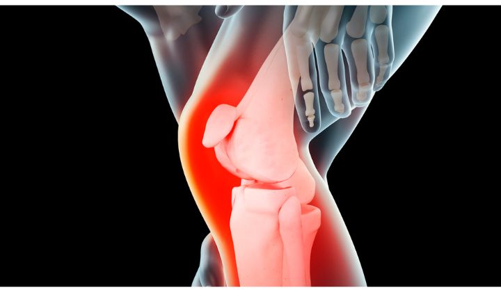 Hoci artroskopia kolena je považovaná za relatívne bezpečný zákrok, ako pri každej chirurgickej operácii, existuje riziko komplikácií.